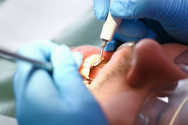 Best Urgent Care for Lost Fillings or Crowns in Cody, WY